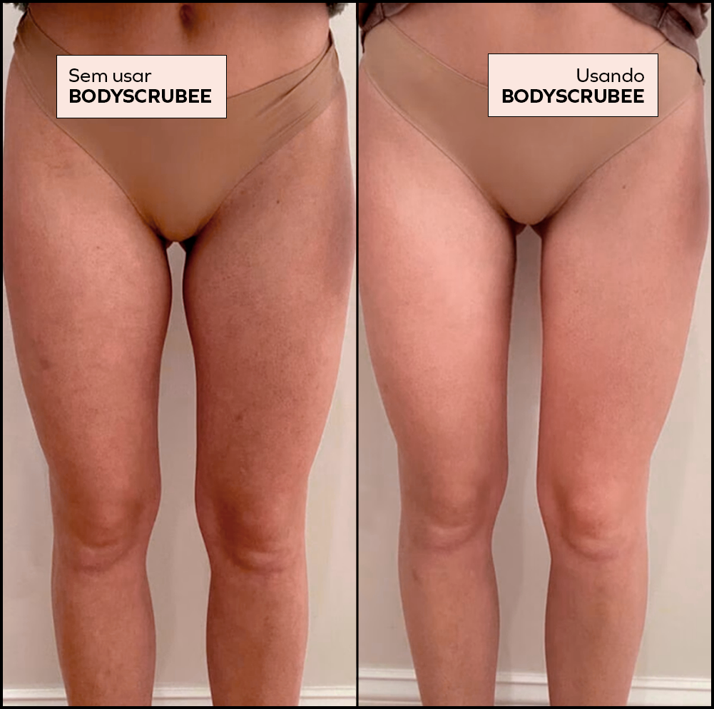 Bodyscrubee - Esfoliante corporal