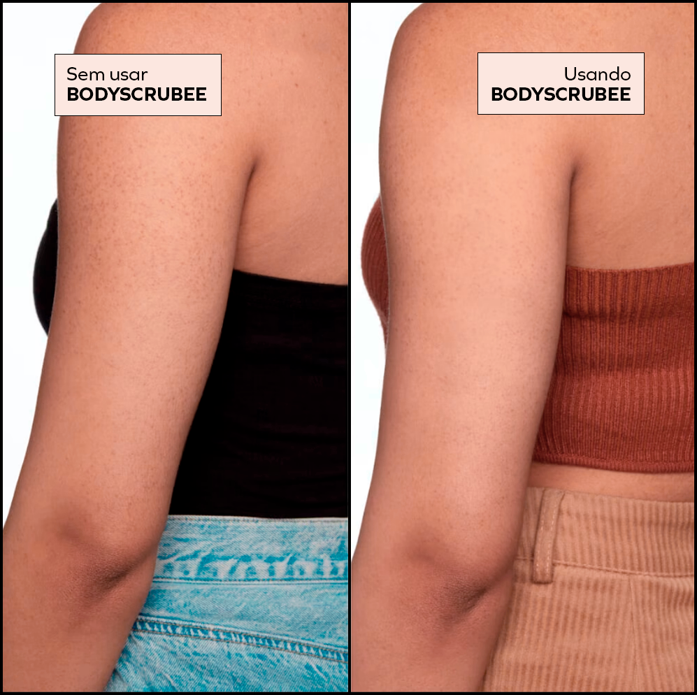 Bodyscrubee - Esfoliante corporal