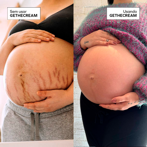 Gethecream - Hidratante corporal